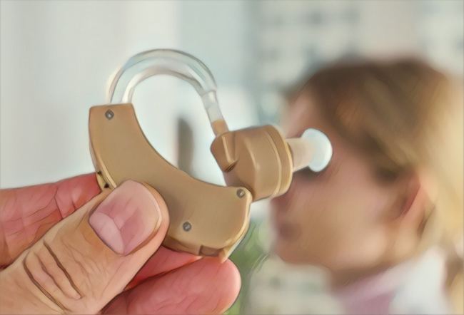 The saga of the cochlear implant